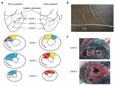 Contribution of Depolarization and Repolarization Changes to J-Wave Generation and Ventricular Fibrillation in Ischemia